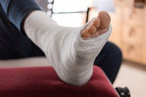 foot in a cast