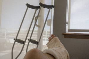 propped-up foot in a cast near crutches